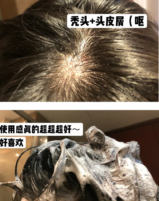 dnf更新补丁安装在哪_dnf安装卡在7z.dll_dnf安装不了