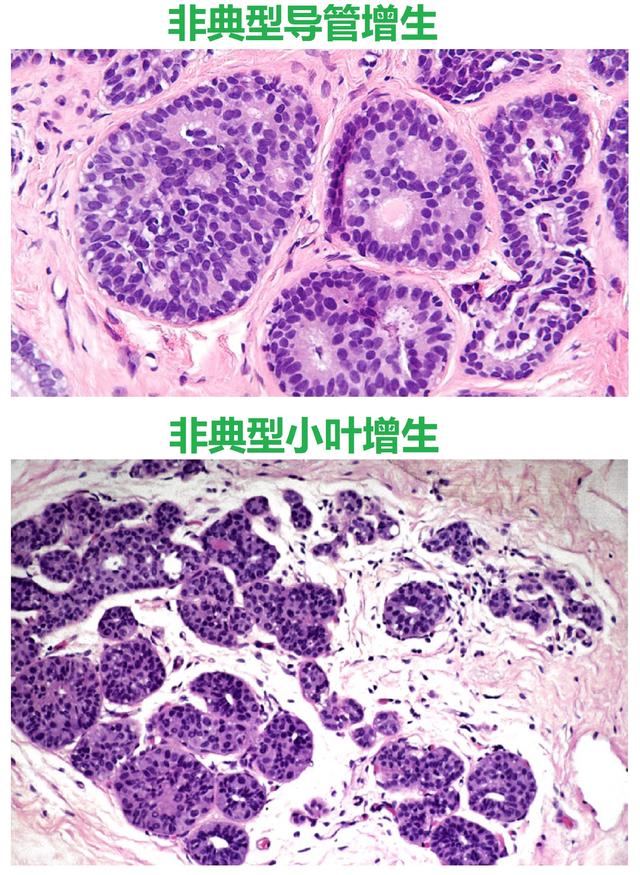 初级蛋白油怎么做_初级蛋白油怎么制作_初级蛋白油做面膜好吗