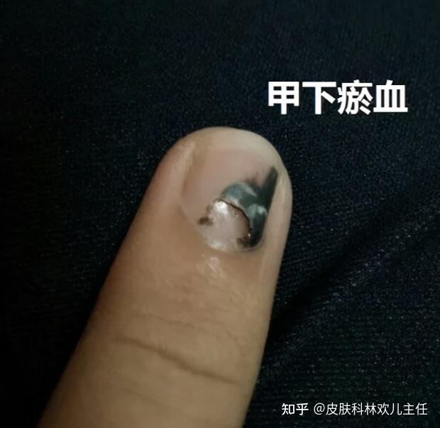 资深员工突然停职，戒指的意义是否已消散？热血无赖的离职引发热议