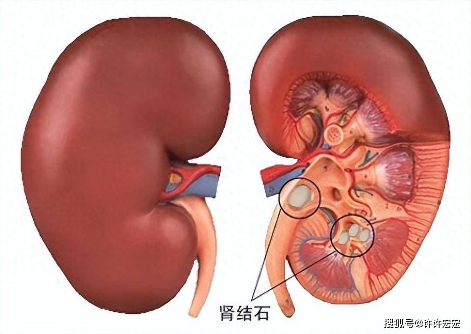 吐槽英雄联盟设计师的句子_吐槽英雄联盟神话版本_吐槽英雄联盟