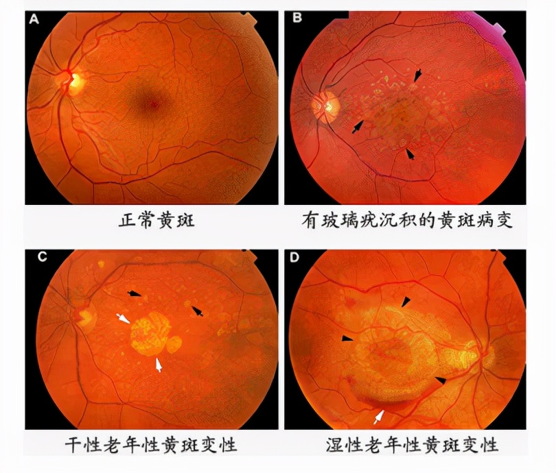 疲劳值_疲劳值燃烧模式什么意思_疲劳值商店在哪